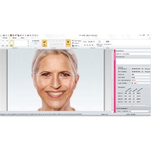 VITA Tooth Configurator Software